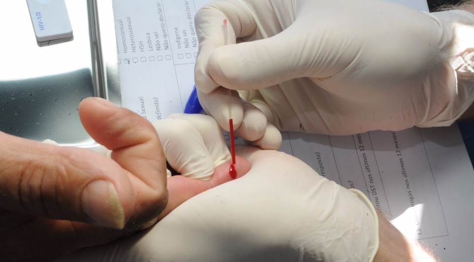 Ministério da Saúde estima que cerca de 135 mil brasileiros não sabem que têm HIV