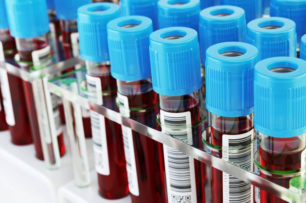 Exame de sangue poderá diagnosticar Alzheimer