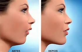 Clientes da Unimed JP ganham rede de  referência em cirurgia bucomaxilo facial