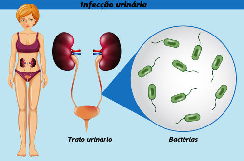 SAÚDE: Infecção urinária atinge mais as mulheres; saiba motivos e os tratamentos indicados