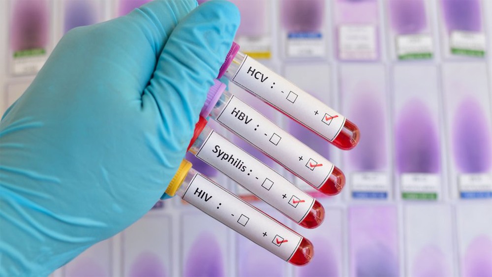 Infecções sexualmente transmissíveis estão em alta no Brasil