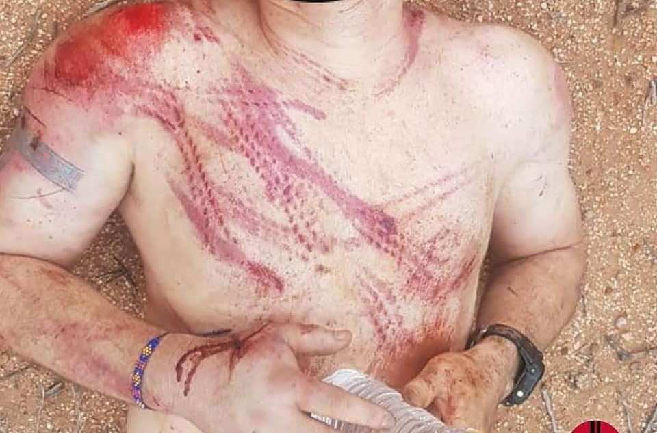 Polícia Civil prende segundo suspeito de espancamento a professor em praça pública na cidade de Serra Branca