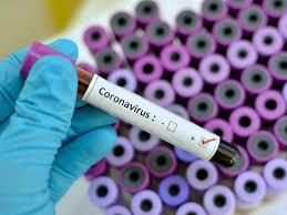 Sobe para 21 o número de óbitos por coronavírus na Paraíba; infectados já são 152