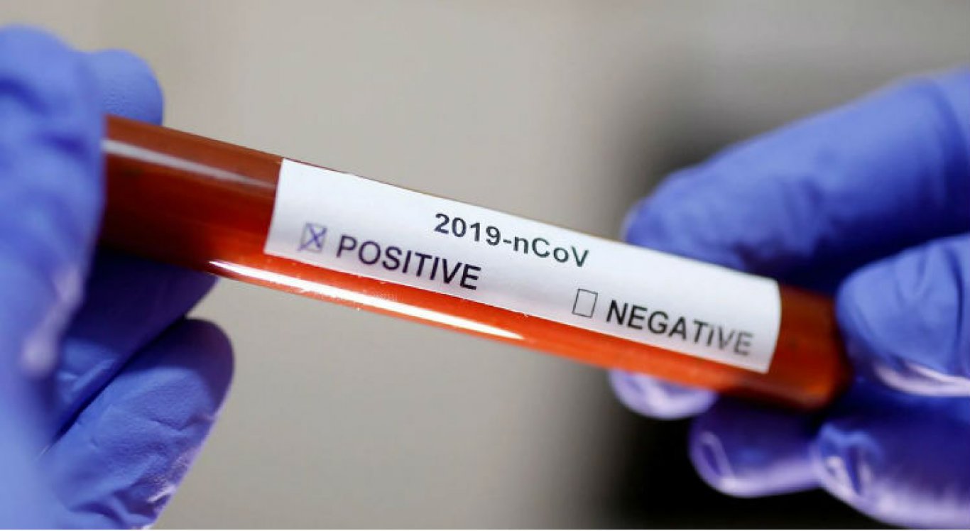 BOLETIM: Estado da Paraíba registra 627 novos casos de Covid-19 e 09 óbitos nesta quinta-feira