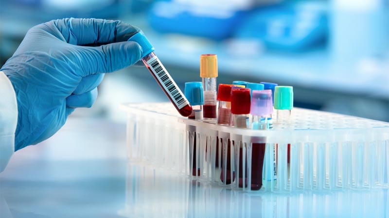 BOLETIM: Com notificação de mortes em 172 cidades, Paraíba registra 19 novos casos de Covid-19 e 08 óbitos, neste domingo