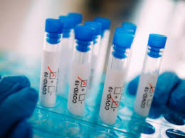 BOLETIM: Paraíba confirma 93 novos casos de Covid-19 e 11 óbitos nas últimas 24h