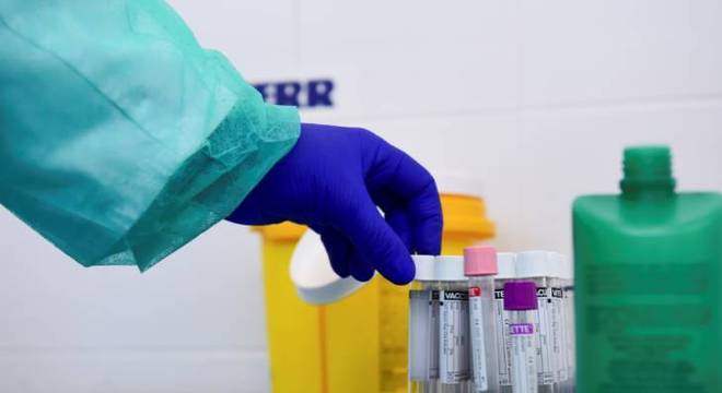 BOLETIM: Com casos de óbitos em 156 municípios, Paraíba registra 798 novos casos de Covid-19 e 18 óbitos