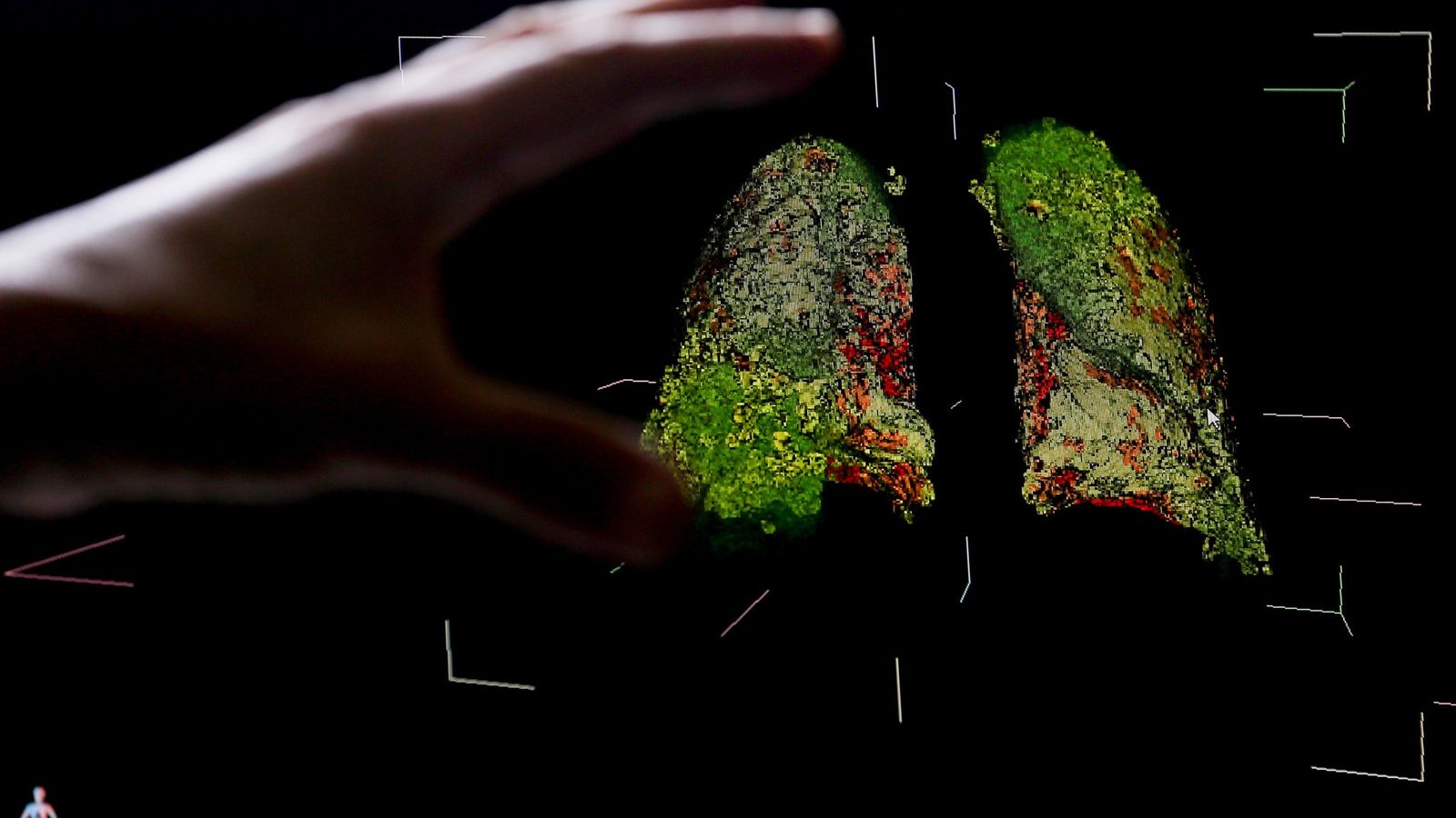 BOLETIM: Paraíba registra 114 novos casos de Covid-19 e 08 óbitos, nesta segunda-feira