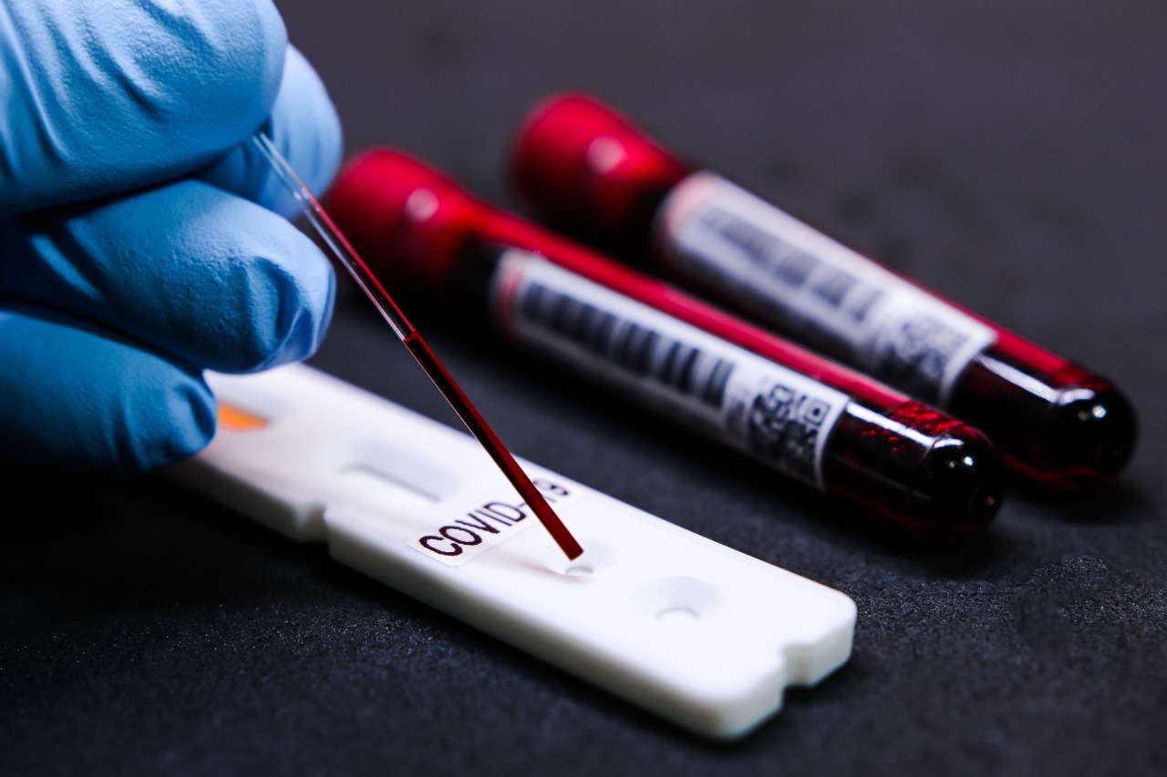 BOLETIM: Paraíba registra 570 casos de Covid-19 e 03 óbitos nas últimas 24h