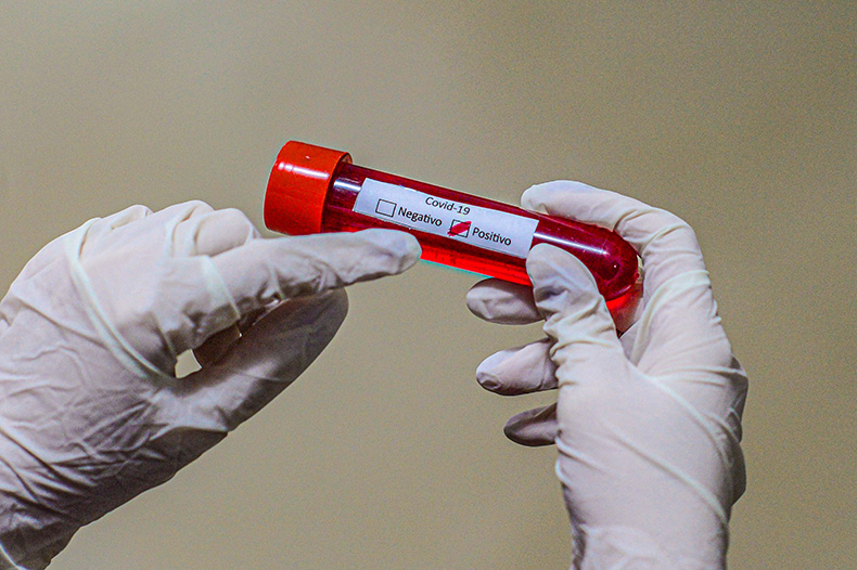 BOLETIM: Paraíba registra 1.949 casos, 01 óbito e 18 pacientes internados por Covid-19 nas últimas 24h