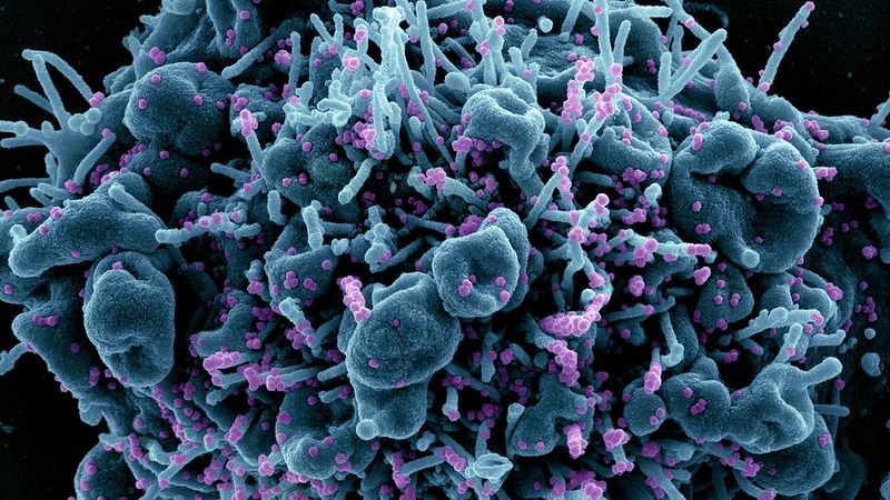 BOLETIM: Paraíba registra 21 óbitos, 4.180 novos casos e 67 pacientes internados por Covid-19 nas últimas 24h
