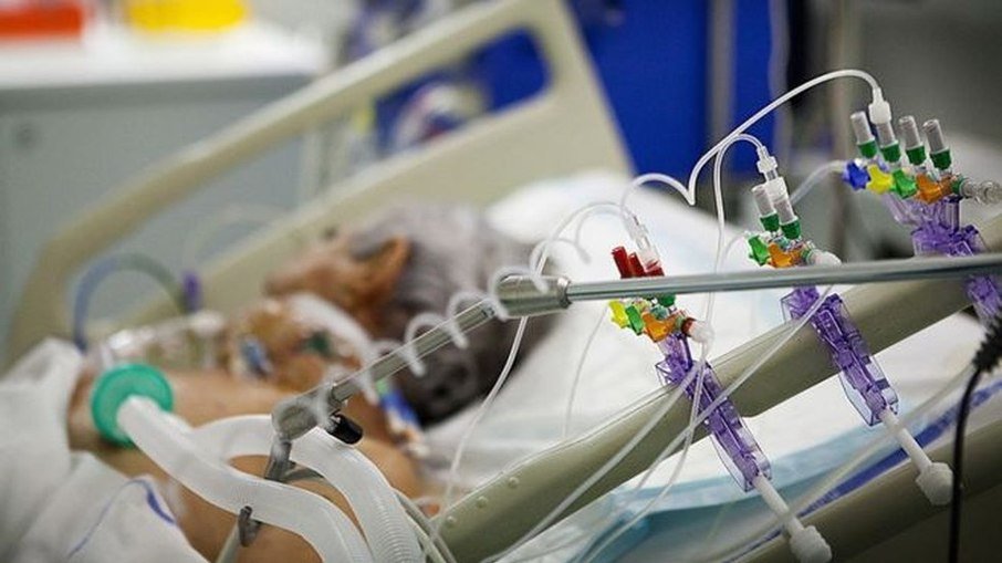 Pesquisa revela que 25% dos pacientes intubados com Covid-19 morrem por sequelas após alta