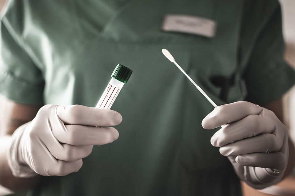 Secretaria de Saúde  de João Pessoa volta a ofertar teste de Covid-19 sem necessidade de solicitação médica