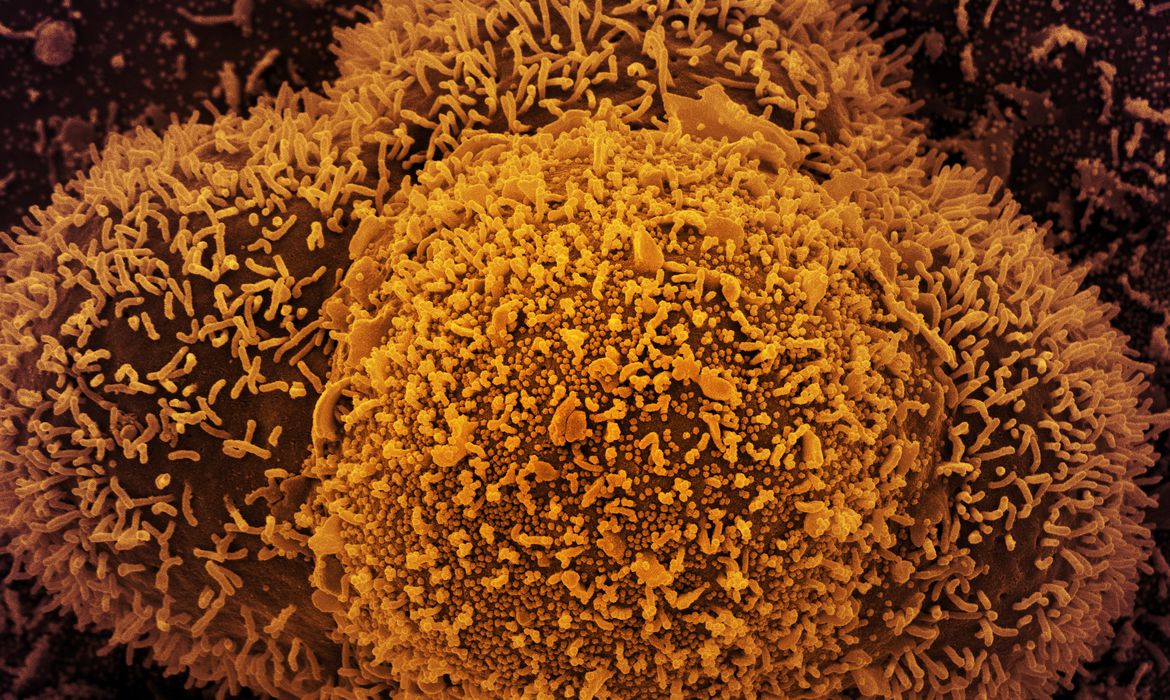 Com a Ômicron, comitê científico do Consórcio Nordeste recomenda proibição de festas de Réveillon e carnaval