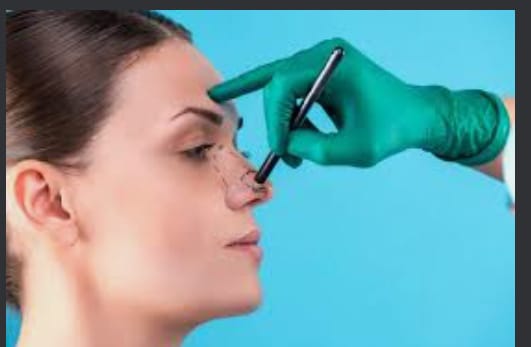 Apontada como uma das cirurgias mais procuradas pelos brasileiros, tudo o que você precisa saber sobre rinoplastia