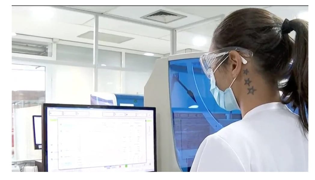 Brasil já tem confirmados 17 casos de pessoas infectadas com a varíola dos macacos e transmissão local da doença