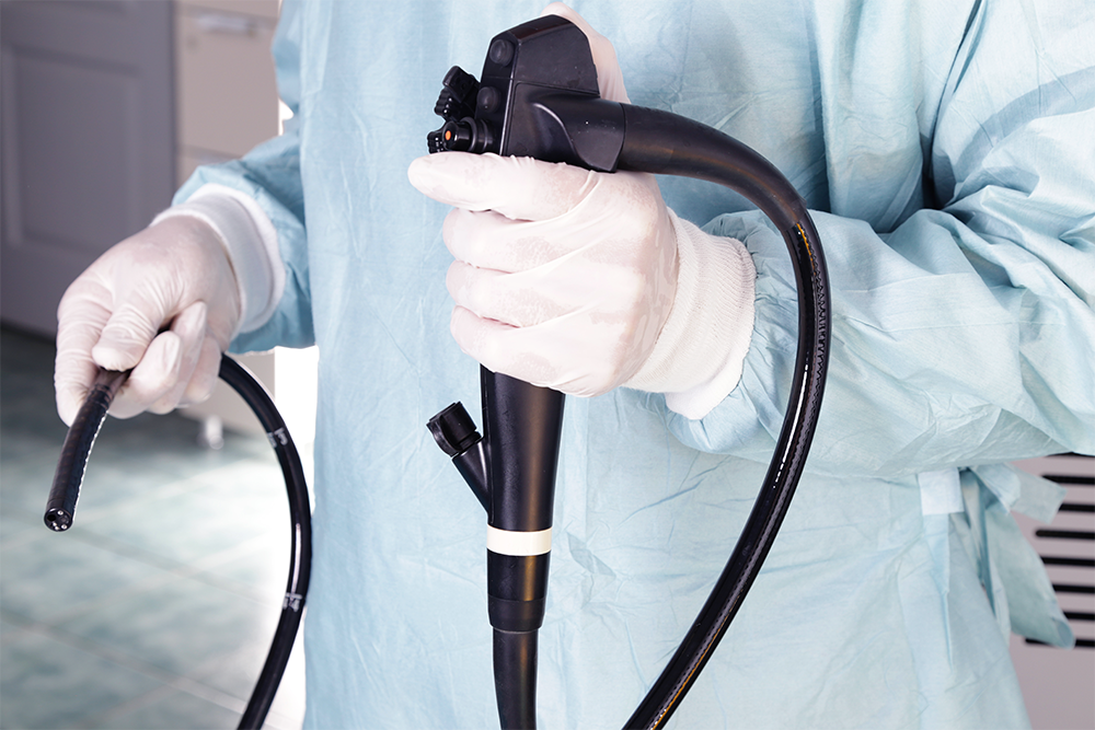 Prevenção ao câncer de intestino: Hospital Municipal Santa Isabel realiza mutirão de colonoscopia na campanha ‘Março Azul’