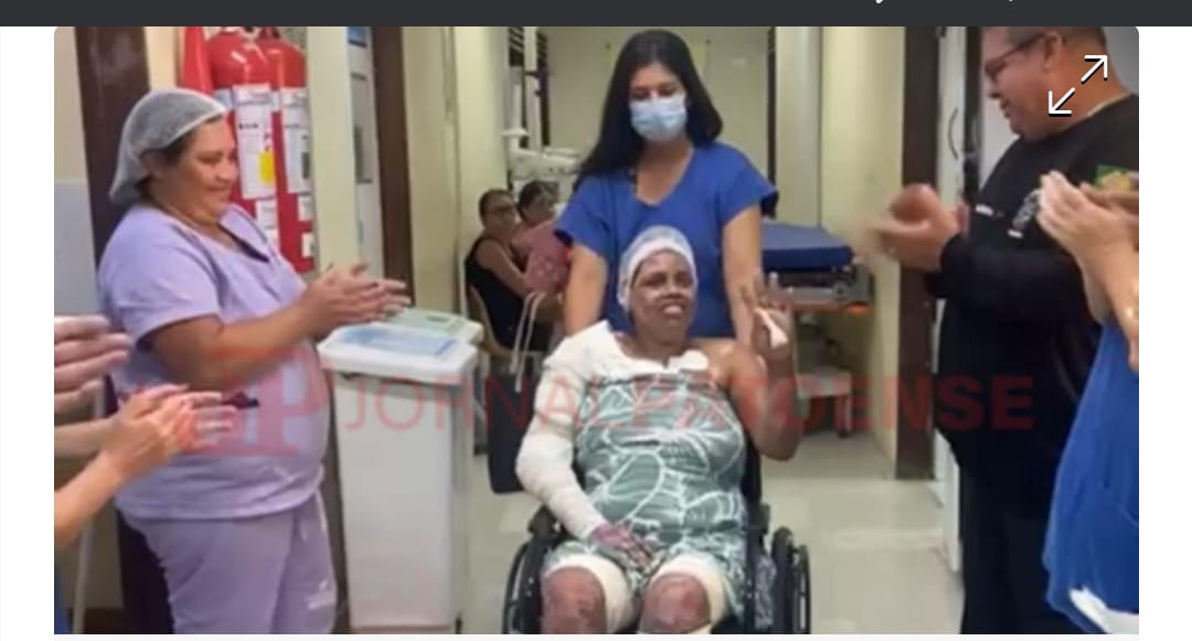 Morre de parada cardiáca mulher que teve 70% do corpo queimado ao utilizar álcool para cozinhar em Patos