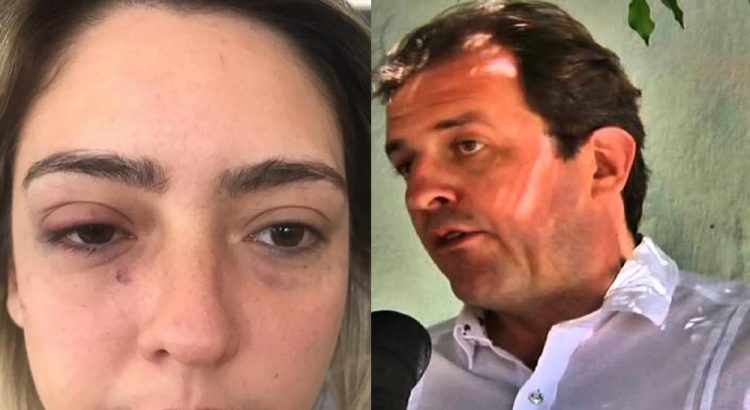 Câmara Criminal do TJPB mantém condenação do prefeito de Sousa, Fábio Tyrone, por espancamento da ex-namorada Myriam Gadelha