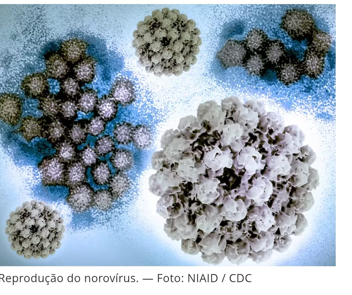 Diarreia intensa: Vírus do vômito se espalha "como um incêndio" na Europa; conheça os sintomas